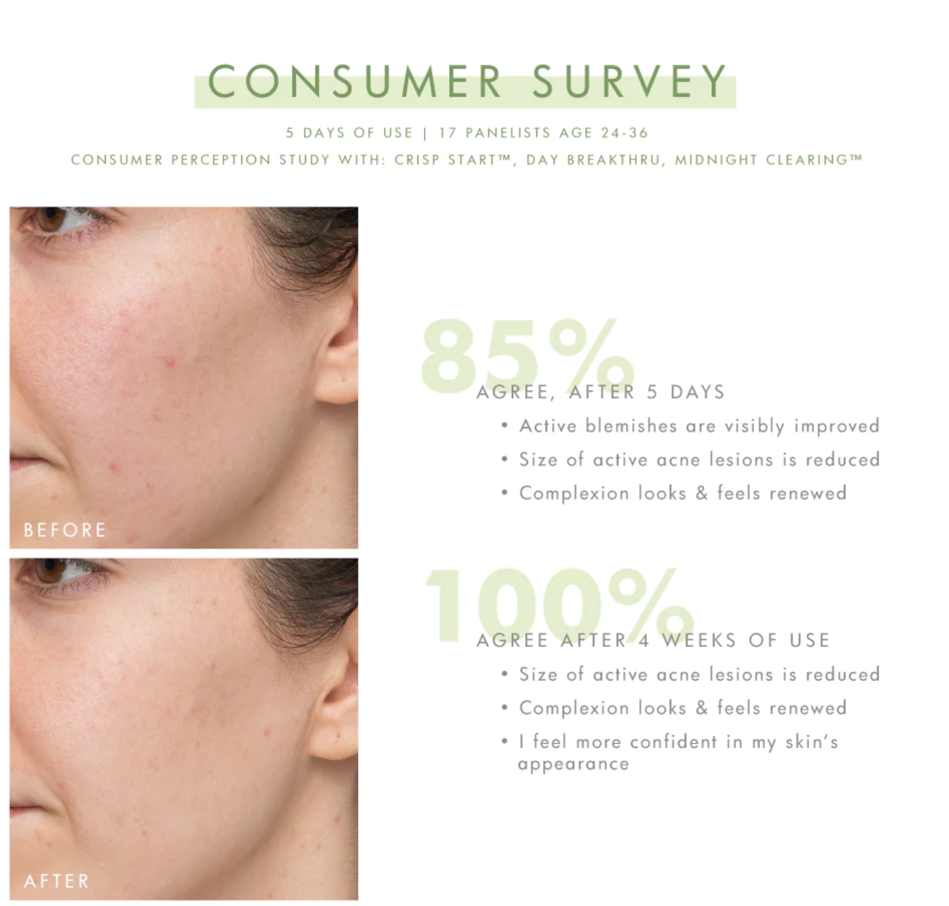 Crisp Start Acne Face Wash